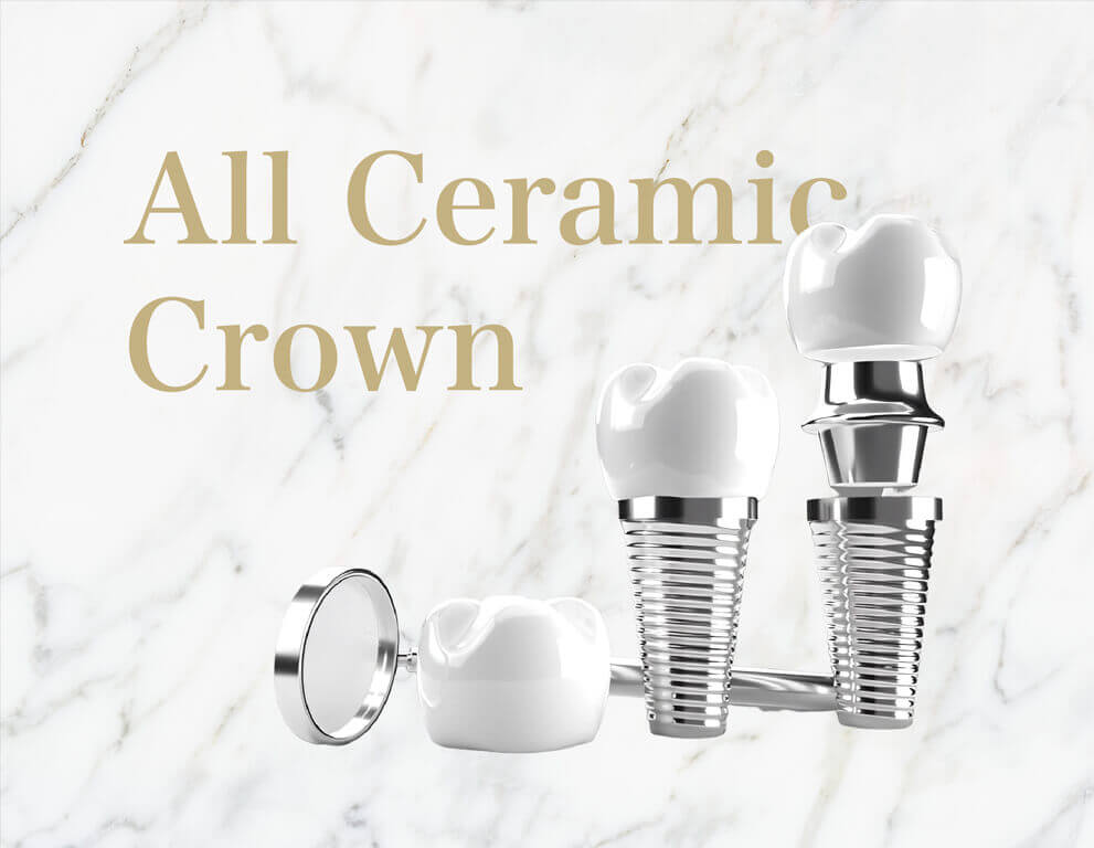 oneday植體&全瓷冠